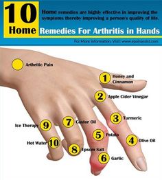 Remedies For Arthritis In Hands