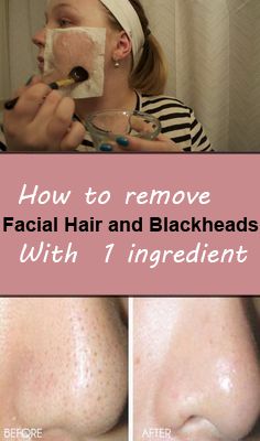 How to remove facial hair and blackheads with 1 ingredient